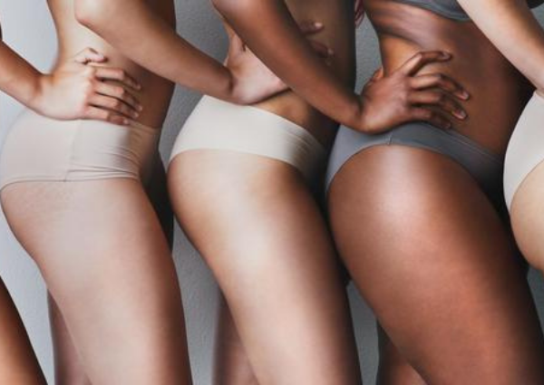 Group of women displaying their stretch marks