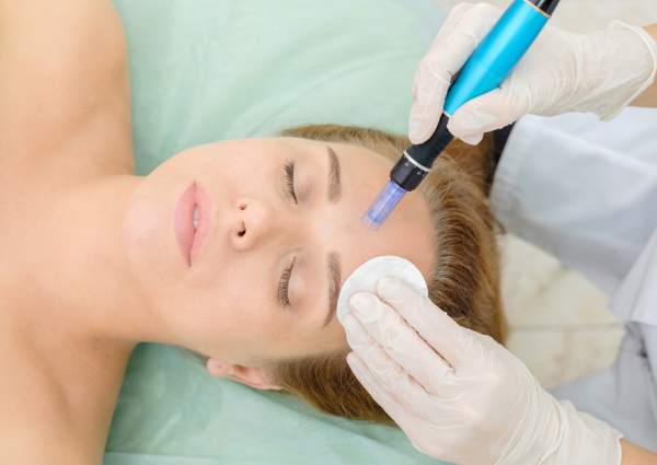  Woman laying down having her forehead microneedled with the Dr Pen A1-W microneedling pen